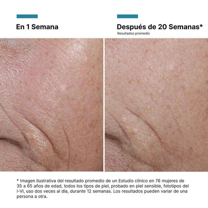 A.G.E. Interrupter Ultra Sérum Skinceuticals | 30 ml